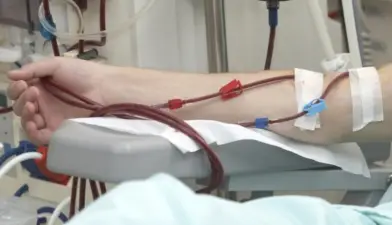 Dr. Manoj Arora providing hemodialysis treatment to a kidney patient at Max Hospital, Delhi