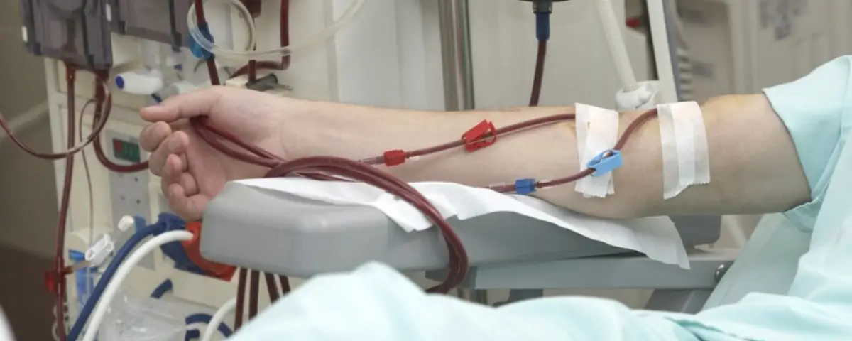 Dr. Manoj Arora providing hemodialysis treatment to a kidney patient at Max Hospital, Delhi