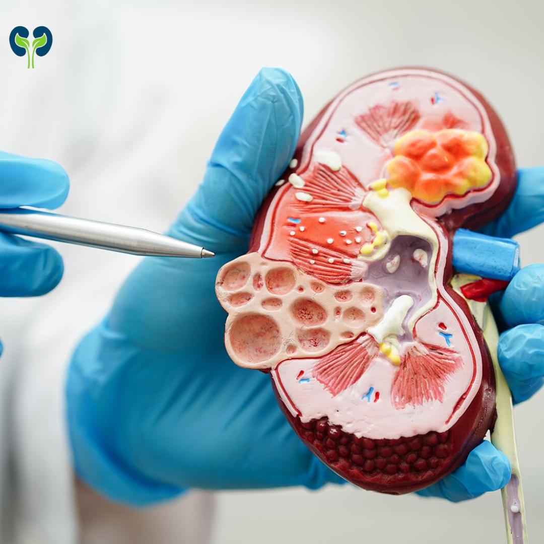 Chronic Kidney Disease